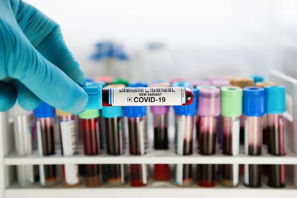 コロナウイルス突然変異の新しい株の血液サンプルチューブを保持分析研究室の研究者 血液サンプルと医師は Covid 19の新変異体とラベルされています — ストック写真