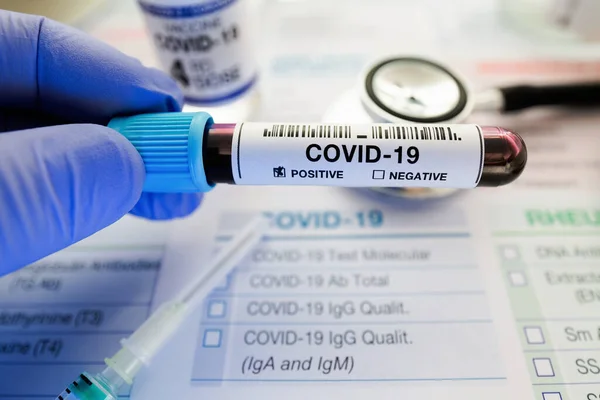 技术人员检测血样中是否存在对日冕病毒呈阳性反应 医生在化验室保存血样管 确诊为Covid 19或Coronavirus阳性 免版税图库图片