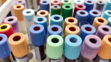 Bulanık arka plan, kan tüpleri testi ve laboratuvardaki biyolojik örnekler. Renk tüpleri grubuyla diğer hastaların kan örnekleriyle birlikte rafın odaklanmamış arka planı