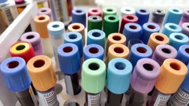 Laboratuvarda kan tüpleri ve biyolojik örnekler test edildi. Diğer hastaların kan örnekleriyle birlikte renk tüpleri grubuyla rafın arka planı