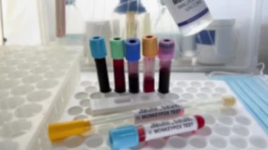 Maymun Çiçeği MPXV hastalığı aşısı şişesi olan bir doktor. Çiçek hastalığı ve Maymun Çiçeği MPXV aşısı için aşı ampulü tutan doktor.