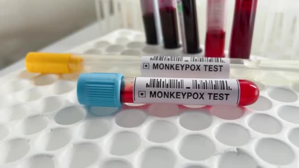 Vzorky Zkumavky Pro Analýzu Diagnostiku Antigenů Protilátek Opičích Neštovic Pracovní — Stock video