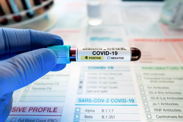 Doctor Holding Tube Blood Sample Laboratory Identified Positive Covid Coronavirus — Stock Photo, Image