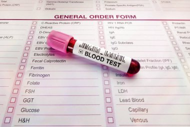 Doktorun tıbbi inceleme için talep ettiği test talebinde bulunan bir hastadan kan testi. Tıbbi laboratuardaki tahlil testlerinin listesiyle birlikte kan testi tüpü ve formu.