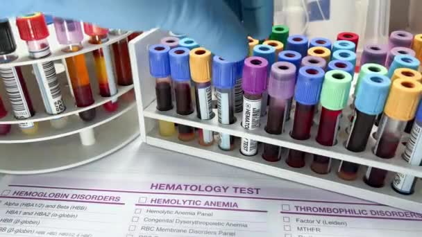 Technikus Labor Vérvizsgálattal Hematológiai Vizsgálatról Vérminta Csövet Tartó Orvos Analízishez — Stock videók