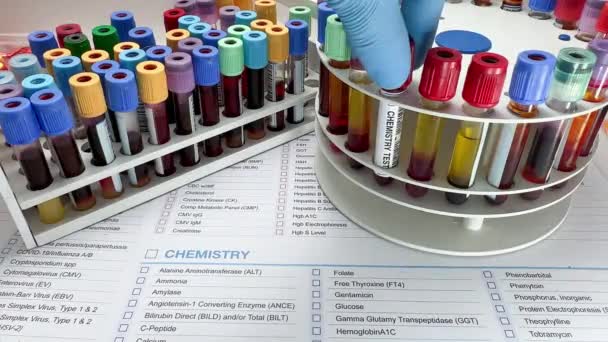 博士は 研究室での血液化学研究の分析のための血液サンプルチューブを保持 血液化学検査のための要求レポートに対する血液検査の技術者研究室 — ストック動画