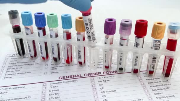 Medico Possesso Provetta Sangue Analisi Studio Chimico Del Sangue Laboratorio — Video Stock