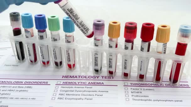 Médico Segurando Tubo Amostra Sangue Para Análise Laboratório Hematologia Assistente — Vídeo de Stock