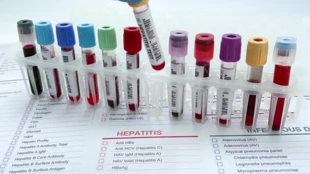 医師は 研究室で肝炎の分析のための血液サンプルチューブを保持 肝炎検査のための血液検査を実施している研究室の技術者のアシスタントまたは医師 — ストック動画