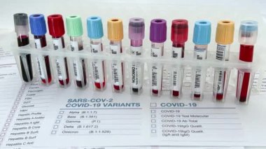 Teknisyen, Covid Omicron analizi için hasta kan örnekleriyle dolu bir raftan tüp alır. Laboratuvar teknisyeni elinde COVID-19 veya Omicron varyant Coronavirus ile tanımlanmış bir kan örneği tüpü tutuyor.