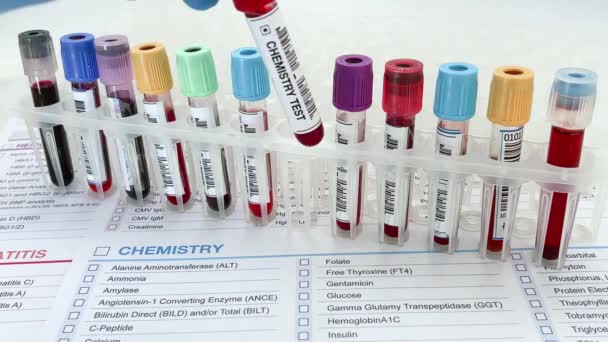 当研究室では血液化学研究の解析用に血液サンプルチューブを保持しています 血液化学検査のための血液検査報告書を保持している研究室の技術者アシスタントまたは医師 — ストック動画