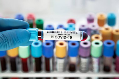 Coronavirus 'a kan testi tüpü taşıyan teknisyen araştırma laboratuarında analiz ediyor. Laboratuvarda yeni Varyant covid-19 teşhisi için kan örneği tüpü tutan araştırmacı.