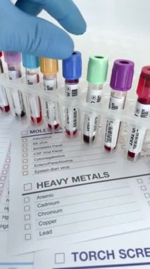 Laboratuvar teknisyeni ağır metal testi için talep raporuna kan testi yapıyor. Laboratuvarda ağır metallerin analizi için kan örneği tüpü tutan doktor.
