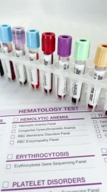Laboratuvar teknisyeni ya da doktor Hematoloji testi için kan testi yapıyor. Doktor hematoloji laboratuvarında analiz için kan örneği tüpü tutuyor.