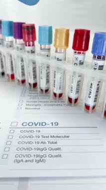 Doktor, laboratuvarda COVID-19 Yeni Coronavirüs ile tanımlanmış bir kan örneği tüpü tutuyor. Teknisyen, Covid 'in yeni varyant analizi için hasta kan örnekleriyle dolu bir raftan tüp alır.