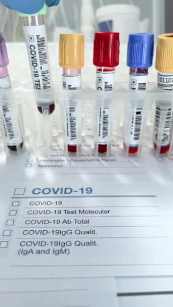 Orvos Vesz Egy Vérminta Cső Azonosított Covid Variáns Coronavirus Laboratóriumban — Stock videók