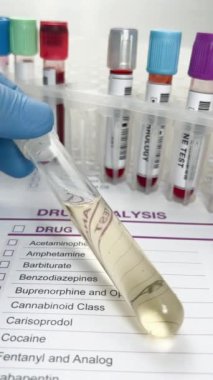 Doktorun elinde idrar tahlili ve uyuşturucu testi veya alkol için kan örnekleri var. Doping veya uyuşturucu analizi için idrar ve kan tüpü testi tutan bir el doktoru.