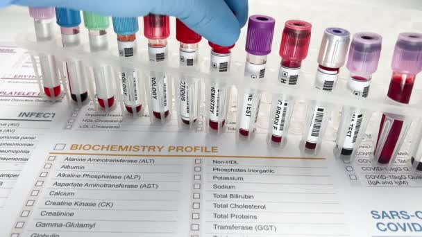 从病人身上提取血液 在生化实验室进行样品分析 在实验室处理血液样本进行生化分析的一位生物化学家的手 — 图库视频影像