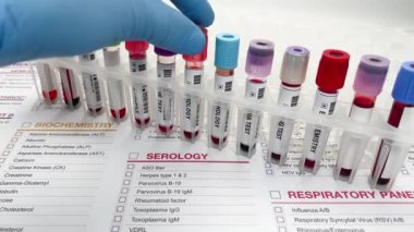 Doktor, laboratuvarda Seroloji teşhisi için kan örneğiyle çalışıyor. Laboratuvarda Seroloji analizi için bir hastadan alınan kan örnekleri.