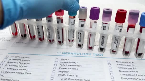 Teknisyen Laboratuvarı Böbrek Fonksiyon Testi Için Talep Formuyla Kan Örneği — Stok video