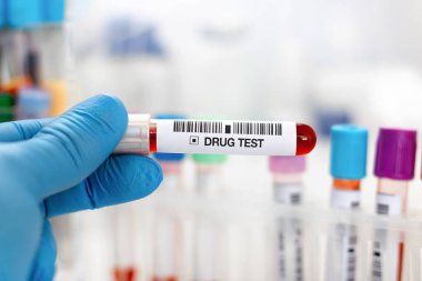 Doktorun elinde idrar tahlili ve uyuşturucu testi ya da alkol için kan örneği var. Doping veya uyuşturucu analizi için idrar ve kan tüpü testi tutan bir el doktoru.