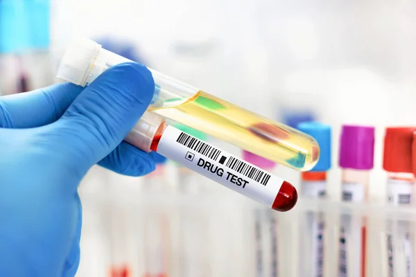 Hand Doctor Holding Urine Blood Tube Test Analysis Doping Drugs — Stock Photo, Image