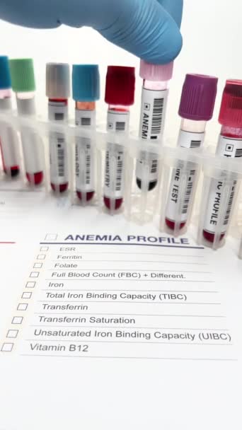 Amostra Sangue Paciente Para Análise Anemia Médico Mão Segurando Tubo — Vídeo de Stock