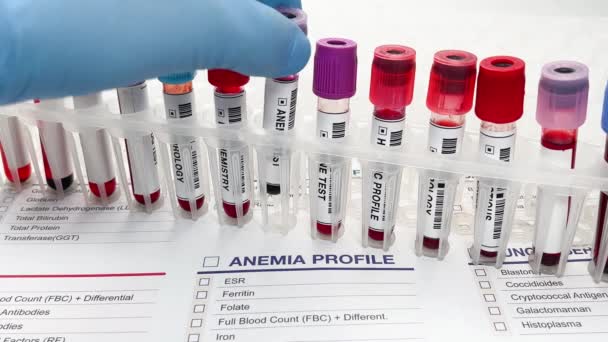 Blood Drawn Sample Patient Analysis Anemia Hand Doctor Holding Blood — Stock Video