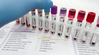 Kimya laboratuarında idrar testi için kan örneği getirdim. Analiz için laboratuvarda kan tüpü testi tutan el doktoru.