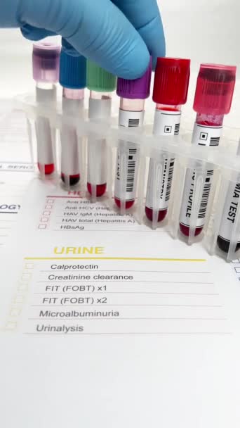 Medicul Mână Care Ține Testul Tubului Sânge Pentru Analiză Laborator — Videoclip de stoc