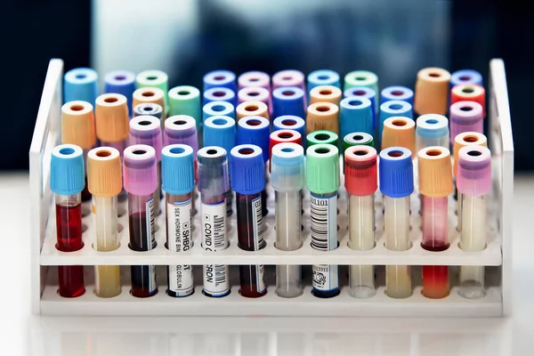 血液検査室の作業台のトレイのチューブ 血液学研究所の分析のために患者から採取したチューブの血液サンプルを — ストック写真