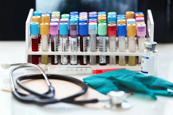 供血科学实验室分析的病人的血管样本 诊所化验室工作台上装有血检管的托盘 — 图库照片