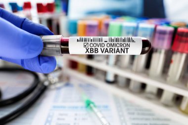 Sars-cov-2 veya Coronavirus 'un Yeni Varyant Omicron XBB' si ile etiketlenmiş kan örneğiyle el. Doktorun elinde COVID-19 Omicron Xbb için pozitif test sonucu bulunan kan tüpü var.
