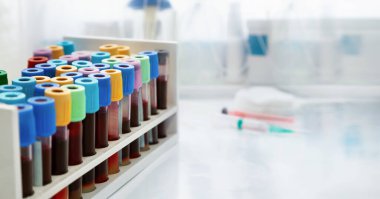 Hematoloji laboratuvarında incelenmek üzere üzerinde kan testleri olan çalışma tezgahı. Hastanenin klinik analiz laboratuvarındaki hastalardan alınan kan örnekleriyle dolu çalışma yeri rafı.