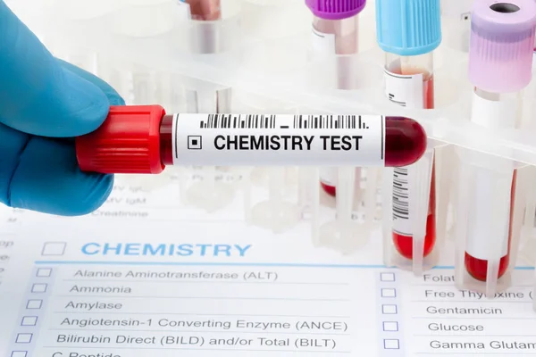Doctor in Laboratory with collection of blood testing sample tube for Chemist analysis. Technician holding tube with blood sample from patient in the Chemistry test lab