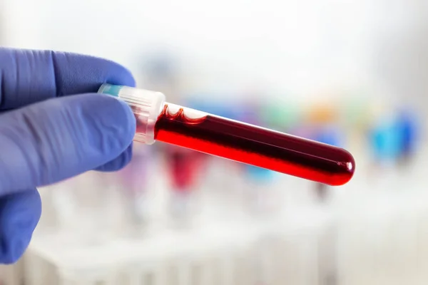 研究室で分析する血液検査管を持つ技術者 研究室で新しいバリアントCovid 19診断のための血液サンプルチューブを保持している研究者 — ストック写真