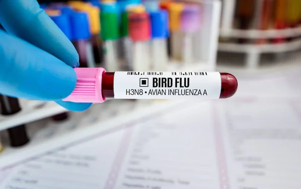 鳥インフルエンザA H3N8ウイルスの解析のための血液採取管検査技術者 鳥インフルエンザ疾患のための医師保持血管検査 — ストック写真