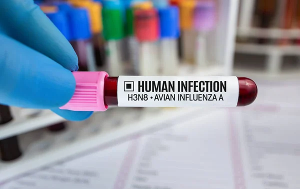鳥インフルエンザの病気のための肯定的な分析と血液収集の技術者 鳥インフルエンザのためのヒト感染症と医師の血管検査を保持H3N8 — ストック写真