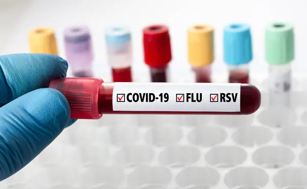 Blood Sample Labeled Covid Flu Rsv Virus Triplemedic Sample Coronavirus Stock Fotografie