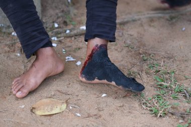 Yangın makyajı özel efekt