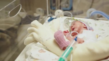 Leylak desenli yün şapkalı küçük kız prematüre bebek, bebek gözüne odaklanmış. Yenidoğan kuvöze yerleştirilir. Yenidoğan yoğun bakım ünitesi