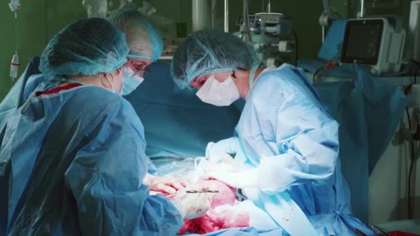 Professionele Chirurg Uitvoeren Van Operatie Met Diverse Verpleegkundigen Stagiaires Groep — Stockvideo