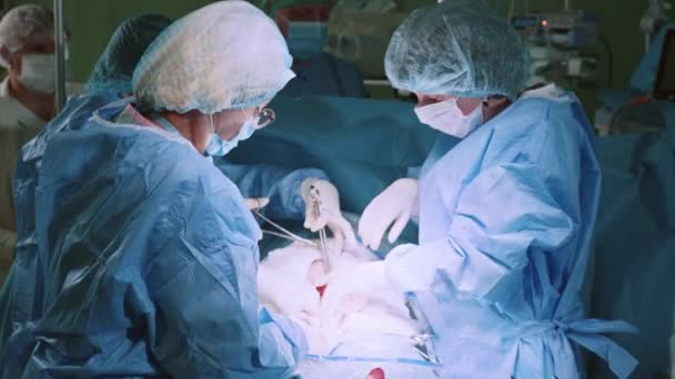 장비를 사용하여 수술을 수행하는 수술을 수행하는 부인과 의사와 Midwives 출산을 — 비디오