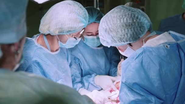 医生使用绝育手术设备进行外科手术 实施外科手术的外科团队 妇科医生和助产士生孩子 产科医院的婴儿 欢迎来到母爱 — 图库视频影像