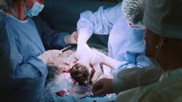 Maternidade Bebê Nascer Por Cesariana Grupo Médicos Máscara Dobrou Cabeça — Vídeo de Stock