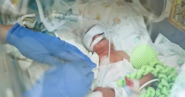 Prematüre yeni doğan bebek hastane kuvözünde yoğun bakımda tıbbi personel yardımıyla tedavi görüyor. Bebeğin narinliği ve tıbbi desteğe ihtiyacı var. Yenidoğan yoğun bakım ünitesi. Bebek kurtarma..