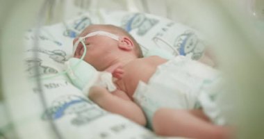 Kuluçka makinesinde nefes borusu olan küçük bir çocuk bebeğe odaklanıyor. Prematüre bebekler için yeni doğan yoğun bakım ünitesi. Sezaryenden sonra prematüre yeni doğan erkek bebek küvezde.