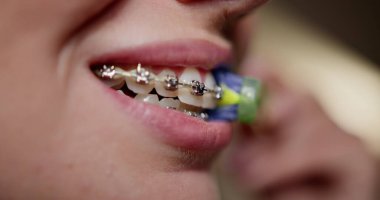 Close-up of woman brushing dental braces with toothbrush. Oral hygiene and health care. Girl maintaining orthodontic treatment by cleaning braces. Brushing Dental Braces With Toothbrush At Home clipart