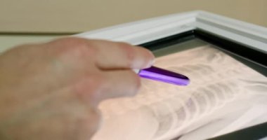 Elle röntgen görüntüsüne dikkat çekerek, analiz için önemli tıbbi detayları ve sezgileri vurgulamak. Sağlık hizmetleri için detaylı bir tıbbi inceleme sürecinde ultrason görüntülemesi kullanıldı