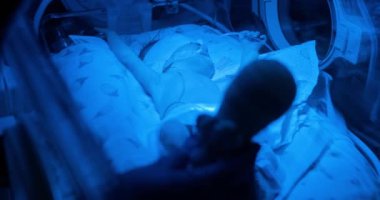 Yeni doğmuş bir bebek, sarılık tedavisi için mavi ışık terapisi gördüğü bir kuvöze yerleştirilir. Yeni doğmuş bir bebeğe mavi ışık altında tıbbi bir kuluçkada bakılıyor.